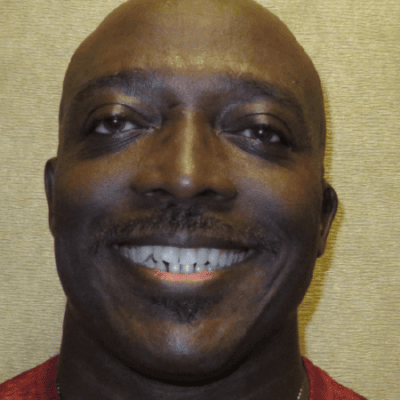 Man smiling before treatment
