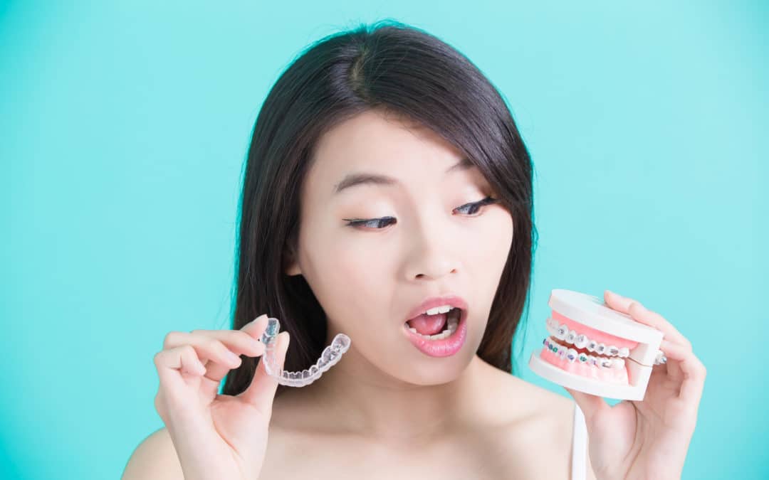 Invisalign vs Braces: Which Solution Is Best for You?