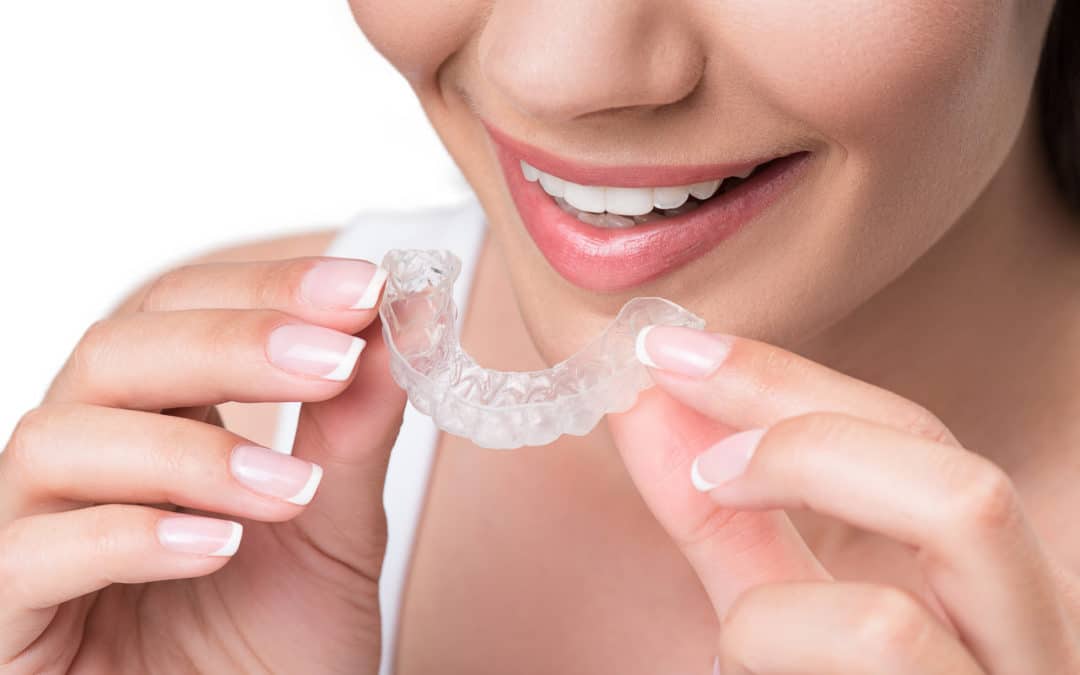 Teeth Shifting? 3 Ways to Find Affordable Braces for Adults