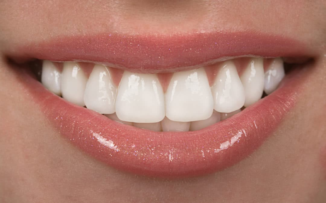 Invisalign Treatment: This Is How Long It Takes to Straighten Teeth