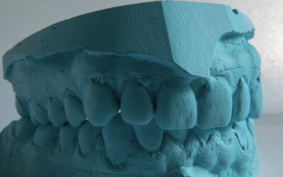 Can You Eat with Invisalign? Tips and Advice for Best Results